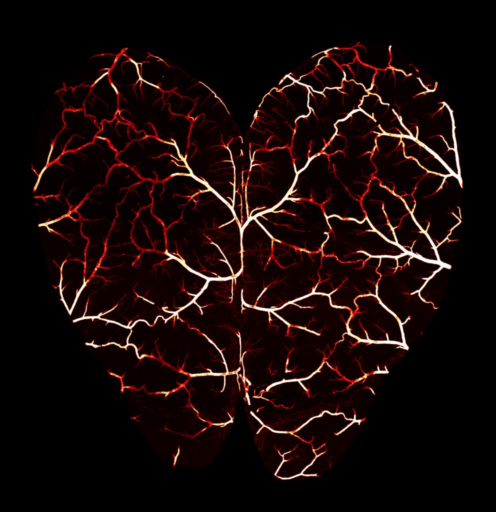 An abstract representation of a heart shape formed by intricately branching blood vessels, set against a black background.