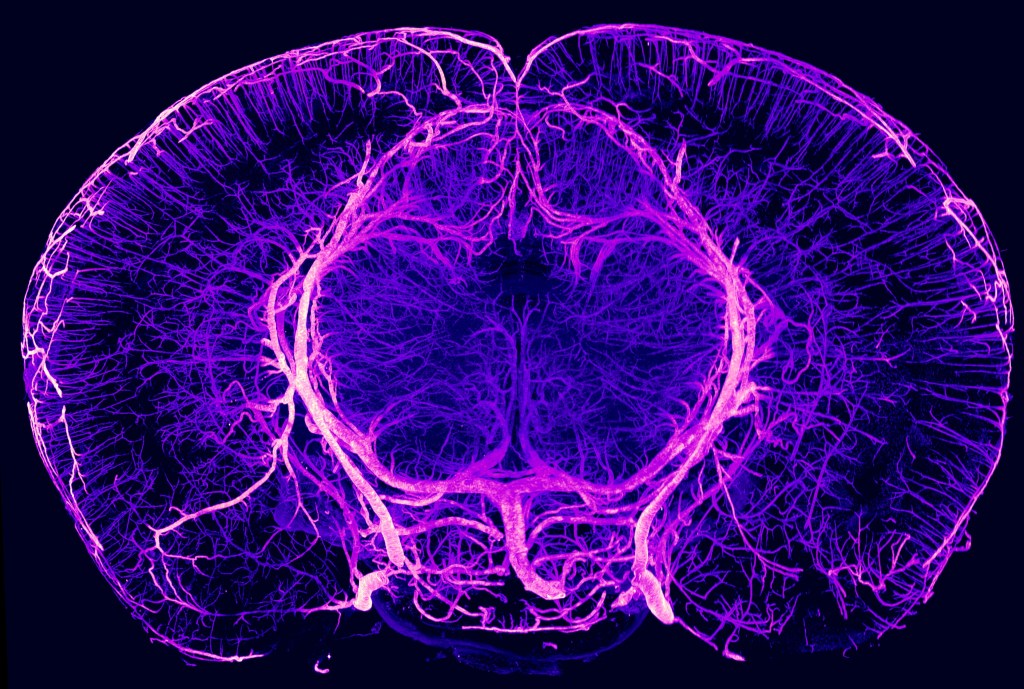 A vibrant purple and pink illustration of a brain's cross-section, showcasing intricate neural pathways and structures.